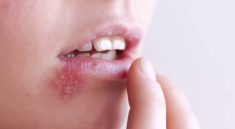 ویروس تبخال می‌تواند باعث افزایش ریسک ابتلا به زوال عقل شود