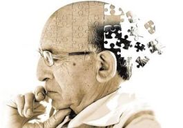 آلزایمر یکی از عوامل اختلالات حافظه است